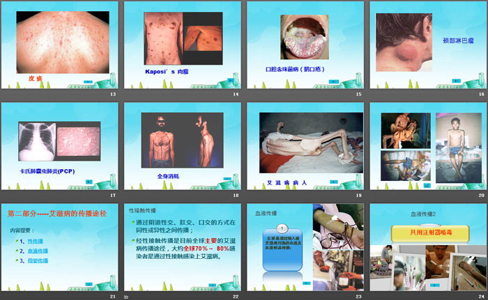 《预防艾滋病知识》PPT