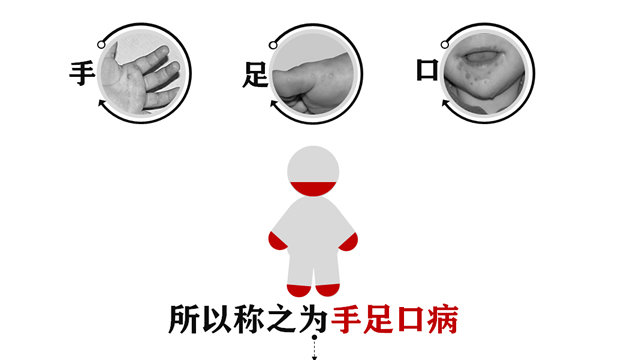儿童手足口病公益教育宣传PPT模板6
